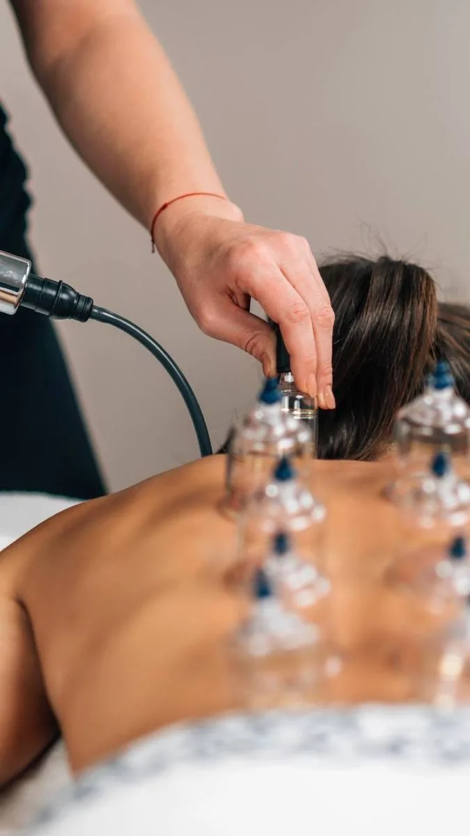 Imagem da terapia Ventosaterapia